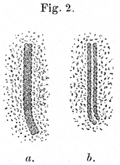 Mit diesem Mikroskop gezeichnetes Zellkerndetail. Abb. aus: Wilhelm Pitzner: &Uuml;ber den feineren Bau der bei der Zelltheilung auftretenden fadenf&ouml;rmigen Differenzierung des Zellkerns. / Ein Beitrag zur Lehre vom Bau des Zellkerns. Morphologisches Jahrbuch 7; Verlag von Wilhelm Engelmann; Leipzig 1882