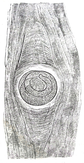 Darstellung der Lehre von den Trichinen, mit R&uuml;cksicht auf die dadurch gebotenen Vorsichtsma&szlig;regeln, f&uuml;r Laien und Aerzte; Rud.Virchow; erste Auflage; Verlag von Georg Reimer; Berlin; 1864: Fig. 2